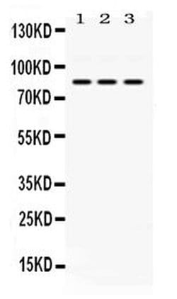 KRIT1 Polyclonal Antibody:Antibodies, Polyclonal