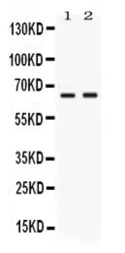 Invitrogen Nectin 4 Polyclonal Antibody 100 &mu;g; Unconjugated:Antibodies,