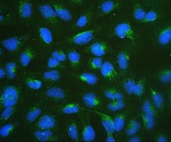 Invitrogen RPSA Polyclonal Antibody 100 &mu;g; Unconjugated:Antibodies,
