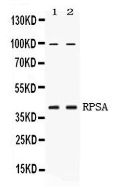 Invitrogen RPSA Polyclonal Antibody 100 &mu;g; Unconjugated:Antibodies,