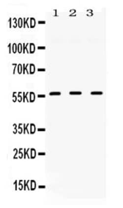 Invitrogen TGFBR1 Polyclonal Antibody 100 &mu;g; Unconjugated:Antibodies,