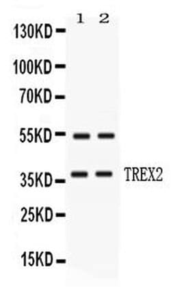 Invitrogen TREX2 Polyclonal Antibody 100 &mu;g; Unconjugated:Antibodies,