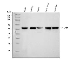 Invitrogen FIBB Polyclonal Antibody 100 &mu;g | Buy Online | Invitrogen&trade; | Fisher Scientific