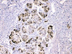 Invitrogen Fibrinogen gamma Polyclonal Antibody 100 &mu;g; Unconjugated:Antibodies,