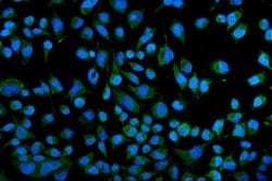 Invitrogen KCNQ1 Polyclonal Antibody 100 &mu;g; Unconjugated:Antibodies,