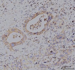 Invitrogen KCNQ1 Polyclonal Antibody 100 &mu;g; Unconjugated:Antibodies,