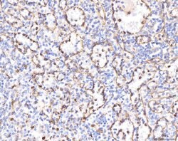 Invitrogen KCNQ1 Polyclonal Antibody 100 &mu;g; Unconjugated:Antibodies,