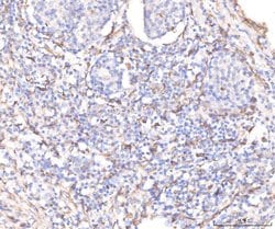 Invitrogen KCNQ1 Polyclonal Antibody 100 &mu;g; Unconjugated:Antibodies,