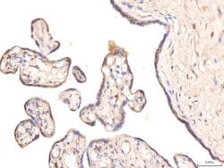 Invitrogen KCNQ1 Polyclonal Antibody 100 &mu;g; Unconjugated:Antibodies,