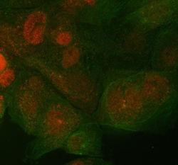 Invitrogen ST7 Polyclonal Antibody 100 &mu;g; Unconjugated:Antibodies,