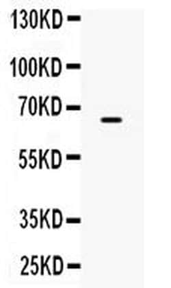 Invitrogen ST7 Polyclonal Antibody 100 &mu;g; Unconjugated:Antibodies,