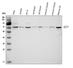 Invitrogen ST7 Polyclonal Antibody 100 &mu;g; Unconjugated:Antibodies,