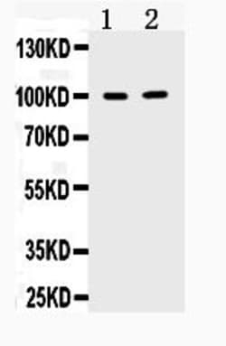 Invitrogen TACC1 Polyclonal Antibody 100 &mu;g; Unconjugated:Antikörper