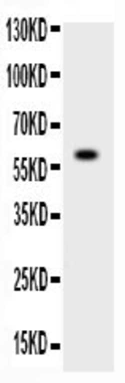 Invitrogen ADAMTS4 Polyclonal Antibody 100 &mu;g; Unconjugated:Antibodies,