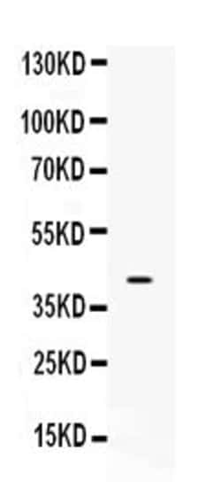 Invitrogen MC2R Polyclonal Antibody 100 &mu;g; Unconjugated:Antibodies,