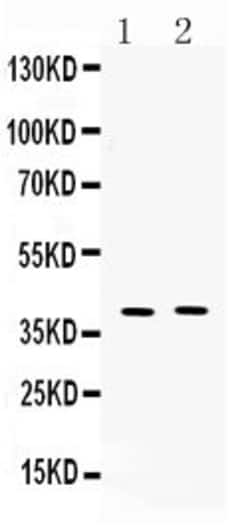 Invitrogen MC3R Polyclonal Antibody 100 &mu;g; Unconjugated:Antibodies,