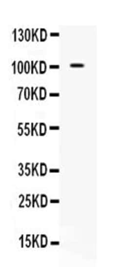 Invitrogen NAA15 Polyclonal Antibody 100 &mu;g | Buy Online | Invitrogen&trade; | Fisher Scientific