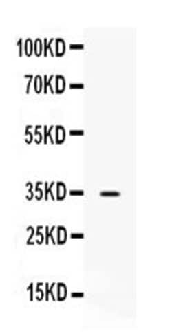 Invitrogen NAT1 Polyclonal Antibody 100 &mu;g; Unconjugated:Antibodies,