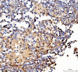 Invitrogen Survivin Polyclonal Antibody 100 &mu;g; Unconjugated:Antibodies,