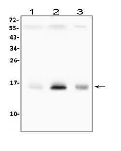 Invitrogen Survivin Polyclonal Antibody 100 &mu;g; Unconjugated:Antibodies,
