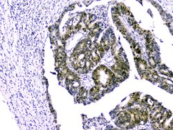 Invitrogen Survivin Polyclonal Antibody 100 &mu;g; Unconjugated:Antibodies,
