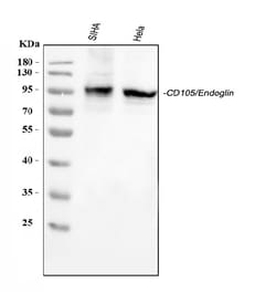 Invitrogen CD105 Polyclonal Antibody 100 &mu;g; Unconjugated:Antibodies,