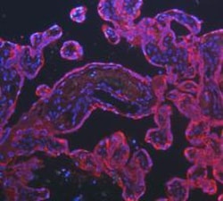 Invitrogen Cytokeratin 8 Polyclonal Antibody 100 &mu;g; Unconjugated:Antibodies,