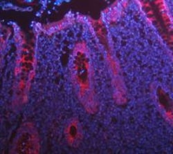 Invitrogen Cytokeratin 8 Polyclonal Antibody 100 &mu;g; Unconjugated:Antibodies,
