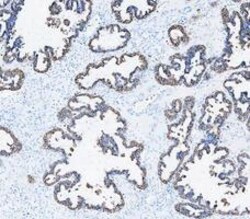 Invitrogen Cytokeratin 8 Polyclonal Antibody 100 &mu;g; Unconjugated:Antibodies,