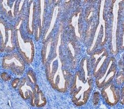 Invitrogen Cytokeratin 8 Polyclonal Antibody 100 &mu;g; Unconjugated:Antibodies,