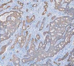 Invitrogen Cytokeratin 8 Polyclonal Antibody 100 &mu;g; Unconjugated:Antibodies,