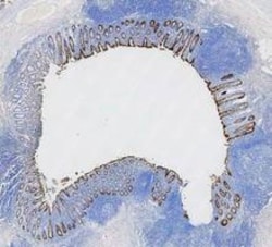 Invitrogen Cytokeratin 8 Polyclonal Antibody 100 &mu;g; Unconjugated:Antibodies,