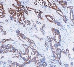 Invitrogen Cytokeratin 8 Polyclonal Antibody 100 &mu;g; Unconjugated:Antibodies,