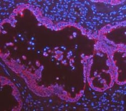 Invitrogen Cytokeratin 8 Polyclonal Antibody 100 &mu;g; Unconjugated:Antibodies,