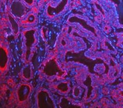 Invitrogen Cytokeratin 8 Polyclonal Antibody 100 &mu;g; Unconjugated:Antibodies,