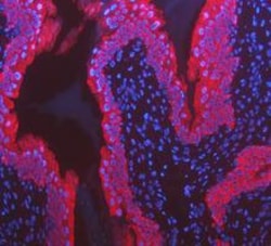 Invitrogen Cytokeratin 8 Polyclonal Antibody 100 &mu;g; Unconjugated:Antibodies,