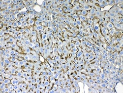Invitrogen Cytokeratin 8 Polyclonal Antibody 100 &mu;g; Unconjugated:Antibodies,