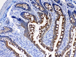 Invitrogen Cytokeratin 8 Polyclonal Antibody 100 &mu;g; Unconjugated:Antibodies,