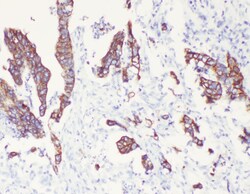 Invitrogen Cytokeratin 8 Polyclonal Antibody 100 &mu;g; Unconjugated:Antibodies,