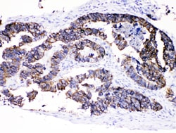 Invitrogen Cytokeratin 8 Polyclonal Antibody 100 &mu;g; Unconjugated:Antibodies,
