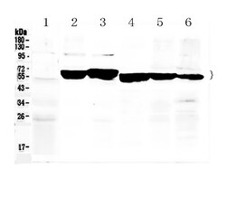 Invitrogen Cytokeratin 8 Polyclonal Antibody 100 &mu;g; Unconjugated:Antibodies,