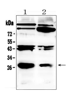 Invitrogen PDGF-B Polyclonal Antibody 100 &mu;g; Unconjugated:Antibodies,