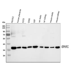Invitrogen SPARC Polyclonal Antibody 100 &mu;g | Buy Online | Invitrogen&trade; | Fisher Scientific
