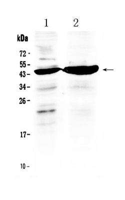Invitrogen TFPI Polyclonal Antibody 100 &mu;g | Buy Online | Invitrogen&trade; | Fisher Scientific