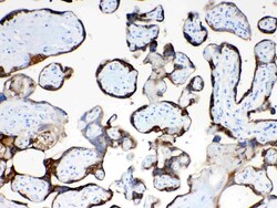 Invitrogen TFPI2 Polyclonal Antibody 100 &mu;g; Unconjugated:Antibodies,