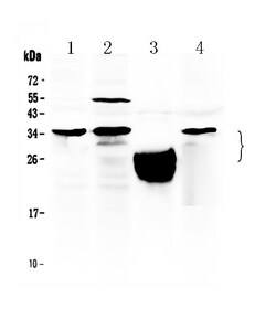 Invitrogen TFPI2 Polyclonal Antibody 100 &mu;g; Unconjugated:Antibodies,