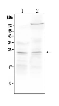 Invitrogen TIMP3 Polyclonal Antibody 100 &mu;g; Unconjugated:Antikroppar