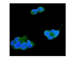 Invitrogen TIMP4 Polyclonal Antibody 100 &mu;g; Unconjugated:Antibodies,