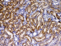 Invitrogen TIMP4 Polyclonal Antibody 100 &mu;g; Unconjugated:Antibodies,