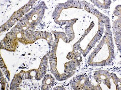 Invitrogen TIMP4 Polyclonal Antibody 100 &mu;g; Unconjugated:Antibodies,